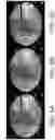 Fig. 06 - System and method for image localization of effecters during a medical procedure