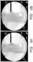 Fig. 07 - System and method for image localization of effecters during a medical procedure