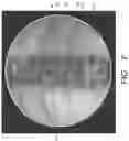Fig. 08 - System and method for image localization of effecters during a medical procedure