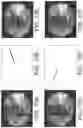 Fig. 12 - System and method for image localization of effecters during a medical procedure