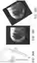 Fig. 15 - System and method for image localization of effecters during a medical procedure