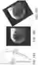 Fig. 17 - System and method for image localization of effecters during a medical procedure
