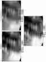 Fig. 24 - System and method for image localization of effecters during a medical procedure
