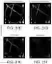 Fig. 28 - System and method for image localization of effecters during a medical procedure