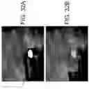 Fig. 33 - System and method for image localization of effecters during a medical procedure