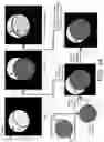 Fig. 35 - System and method for image localization of effecters during a medical procedure