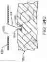 Fig. 49 - Surgical system and method utilizing impulse modeling for controlling an instrument