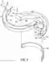 Fig. 08 - Brake assembly for medical device support system