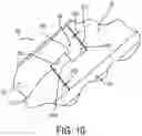 Fig. 09 - Brake assembly for medical device support system