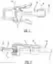 Fig. 03 - Vibrating crown and bridge remover