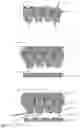 Fig. 02 - Method for producing a dental prosthesis with parallel roots of the prosthetic teeth