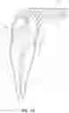 Fig. 04 - Apparatus and methods for cleaning teeth and root canals