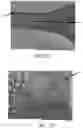 Fig. 48 - Apparatus and methods for cleaning teeth and root canals