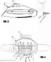 Fig. 03 - Teeth whitening apparatus