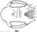 Fig. 04 - Teeth whitening apparatus