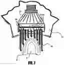 Fig. 06 - Teeth whitening apparatus