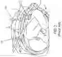 Fig. 03 - SHAPE MEMORY PATCH FOR TISSUE REPAIR