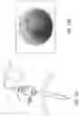 Fig. 13 - SHAPE MEMORY PATCH FOR TISSUE REPAIR