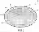 Fig. 03 - IMPLANTABLE PROSTHETIC DEVICE