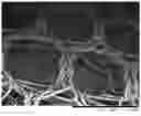 Fig. 01 - Prosthesis comprising a three-dimensional and openworked knit