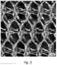 Fig. 04 - Prosthesis comprising a three-dimensional and openworked knit