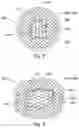 Fig. 05 - Prosthesis comprising a three-dimensional and openworked knit