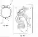 Fig. 07 - Vascular filter device