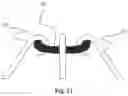 Fig. 09 - Vascular filter device
