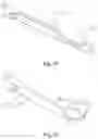 Fig. 11 - Vascular filter device