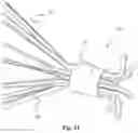 Fig. 15 - Vascular filter device