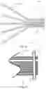 Fig. 35 - Vascular filter device