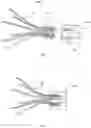 Fig. 49 - Vascular filter device