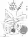 Fig. 03 - EMBOLIZATION PARTICULATES FOR OCCLUDING A BLOOD VESSEL