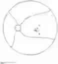 Fig. 09 - Devices and methods for novel retinal irradiance distribution modification to improve and restore vision without producing corneal vitrification