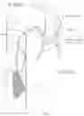 Fig. 05 - LOW PROFILE HEART VALVE AND DELIVERY SYSTEM