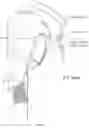 Fig. 06 - LOW PROFILE HEART VALVE AND DELIVERY SYSTEM