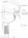 Fig. 07 - LOW PROFILE HEART VALVE AND DELIVERY SYSTEM