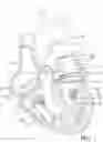 Fig. 02 - Mitral valve prosthesis