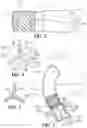 Fig. 03 - Mitral valve prosthesis