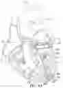 Fig. 05 - Mitral valve prosthesis
