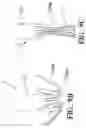 Fig. 06 - Mitral valve prosthesis