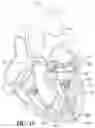 Fig. 07 - Mitral valve prosthesis