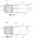 Fig. 08 - Mitral valve prosthesis