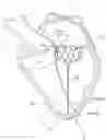 Fig. 01 - Apparatus and methods for anterior valve leaflet management
