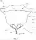 Fig. 02 - Apparatus and methods for anterior valve leaflet management