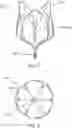 Fig. 06 - Apparatus and methods for anterior valve leaflet management