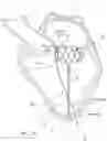 Fig. 12 - Apparatus and methods for anterior valve leaflet management