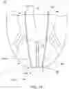 Fig. 13 - Apparatus and methods for anterior valve leaflet management
