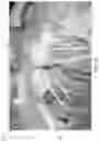 Fig. 17 - Apparatus and methods for anterior valve leaflet management