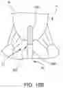 Fig. 19 - Apparatus and methods for anterior valve leaflet management